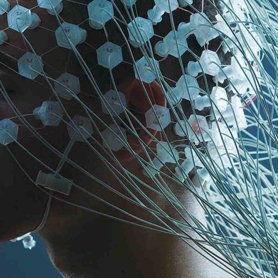  Going wild - Neuralink and Brain-Computer Interfaces